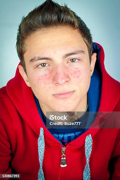 Portrait Of Teenage Boy With Acne Stock Photo - Download Image Now - Beautiful People, Beauty, Boys