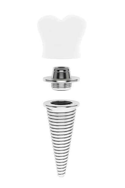 istock Dental concept. Tooth Implant 531027341