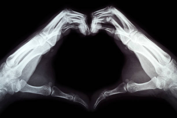 istock x-ray of hands in heart shape 531046391