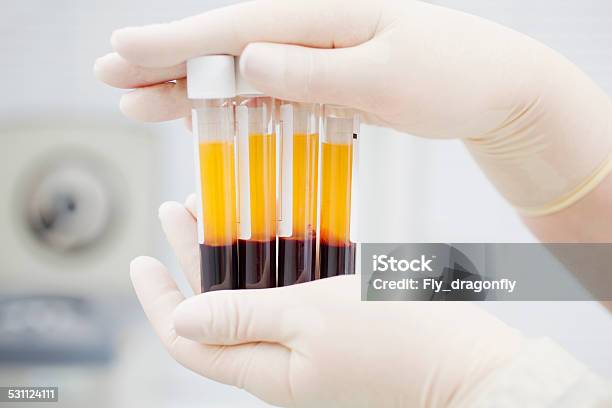 Preparing Blood For Plasmolifting Stock Photo - Download Image Now - Blood Plasma, Platelet, Blood