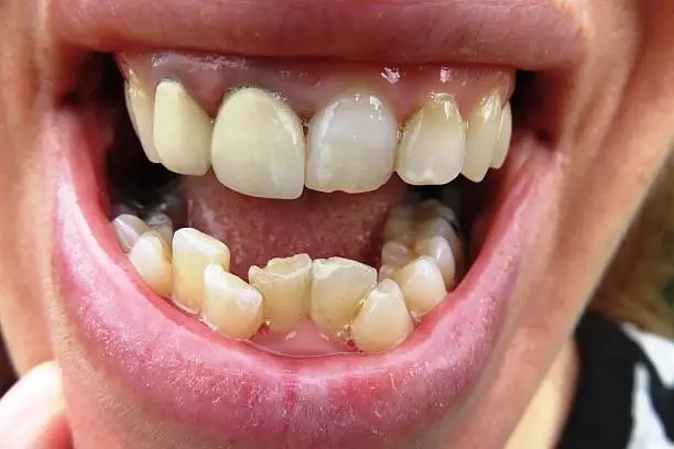Photo of Orthodontic