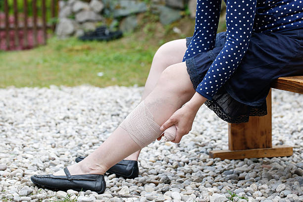 mulher com veias varicosas a aplicação de compressão faixa - stockings human leg female women imagens e fotografias de stock