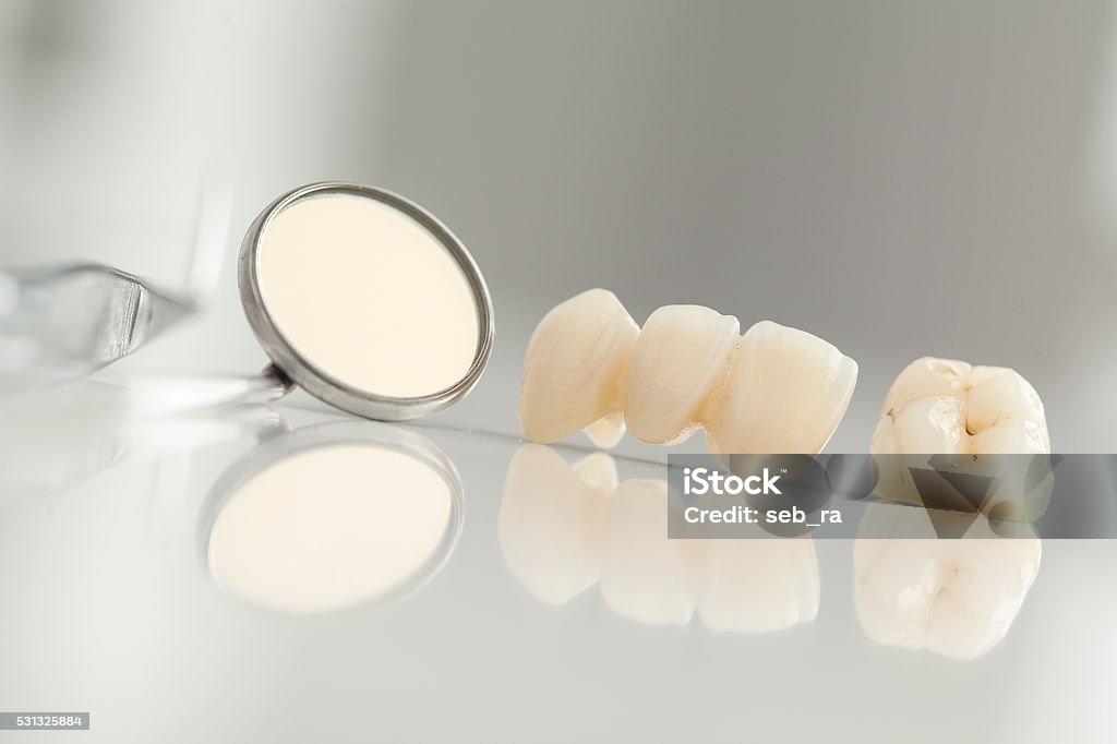 Ceramic bridge close up view Tooth Crown Stock Photo