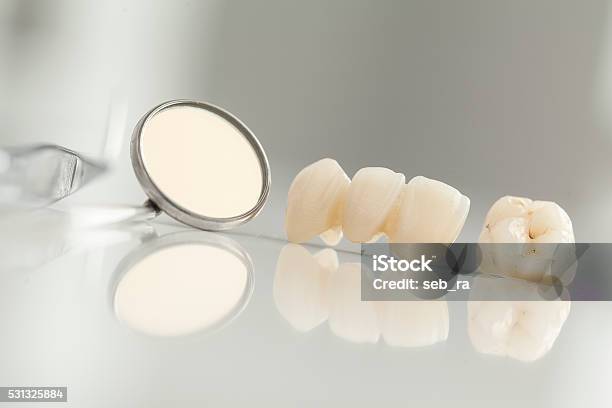 Ceramic Bridge Close Up View Stock Photo - Download Image Now - Tooth Crown, Bridge - Built Structure, Ceramics