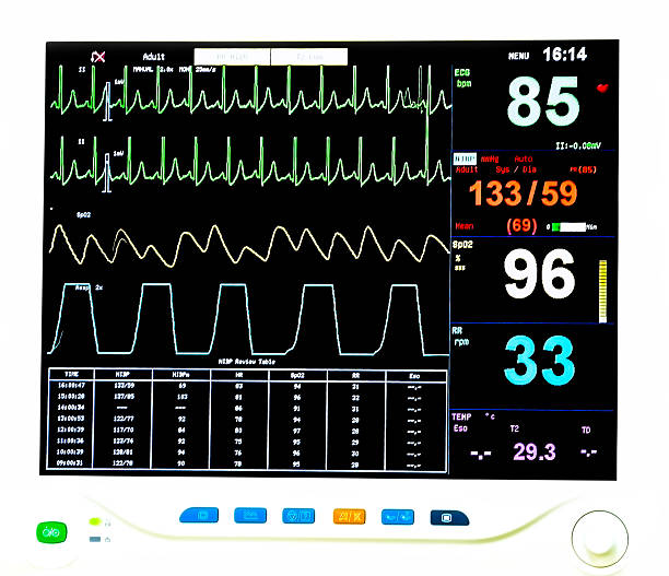 istock EKG monitor 531357069
