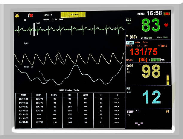 istock EKG monitor 531357081