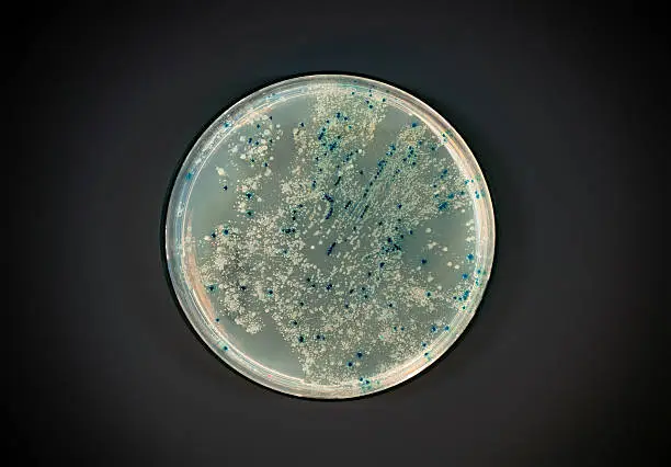 Photo of Agar plate with bacterial colonies on dark background
