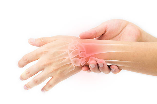 lesión de los huesos de muñeca - pain joint human hand arthritis fotografías e imágenes de stock