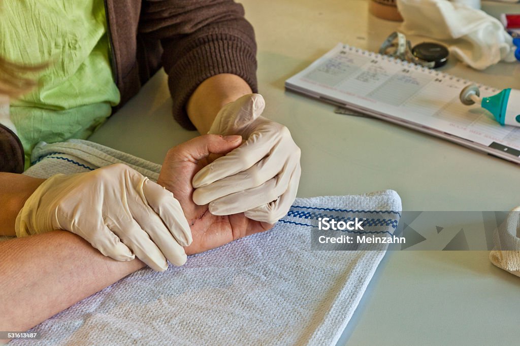 hand physiotherapy to recover a  finger hand physiotherapy to recover a broken finger Occupational Therapy Stock Photo