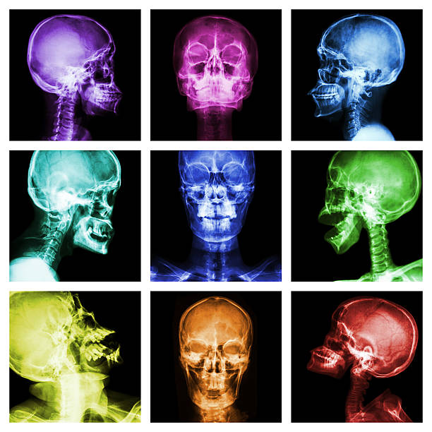 X-ray of your brain