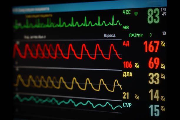 モニタ、カーブ - human heart surveillance computer monitor pulse trace ストックフォトと画像