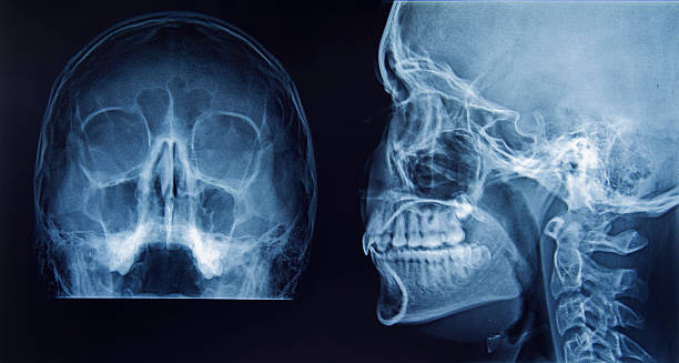 X-Ray of human skull stock photo