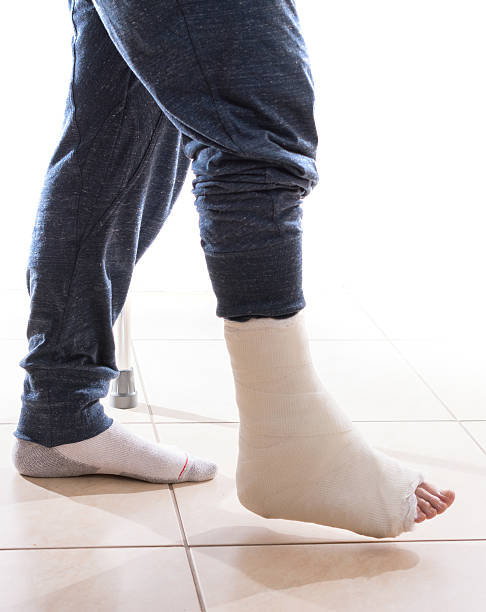 istock Young man with a broken ankle and a leg cast 531795454