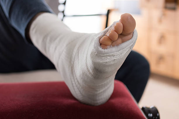 istock Young man with a broken ankle and a leg cast 531796320