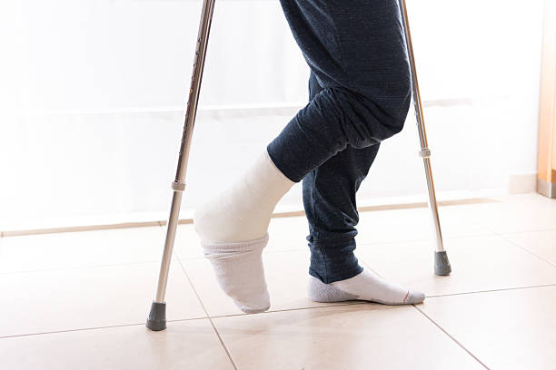 istock Young man with a broken ankle and a leg cast 531796394