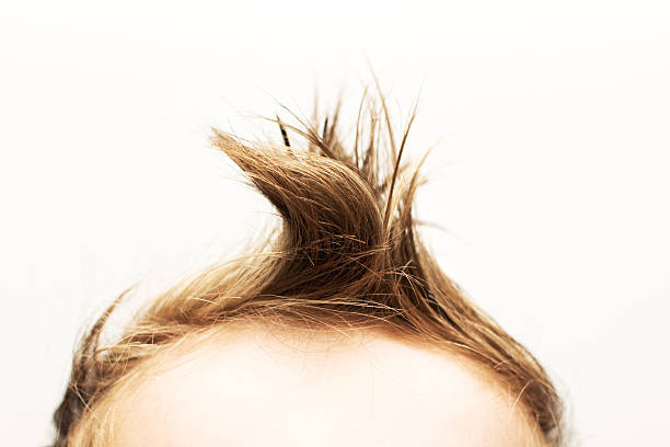 Cowlick Hair Stock Photos, Pictures & Royalty-Free Images - iStock