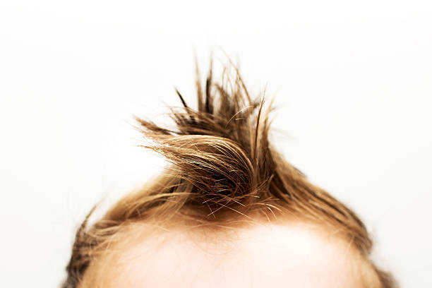 Cowlick Hair Stock Photos, Pictures & Royalty-Free Images - iStock
