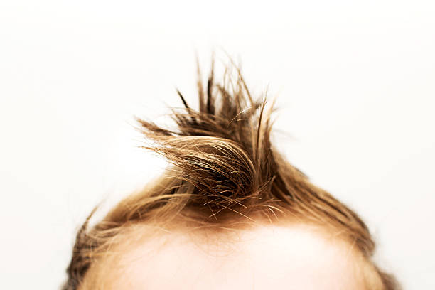 Cowlick Hair Stock Photos, Pictures & Royalty-Free Images - iStock Cowlick Hair Stock Photos, Pictures & Royalty-Free Images - iStock