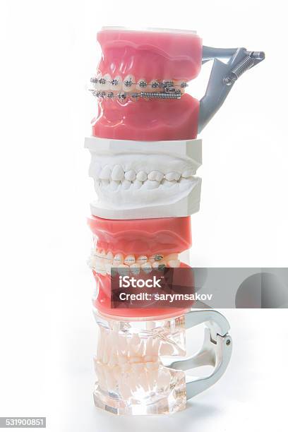 Dental Model Stock Photo - Download Image Now - 2015, Chart, Close-up