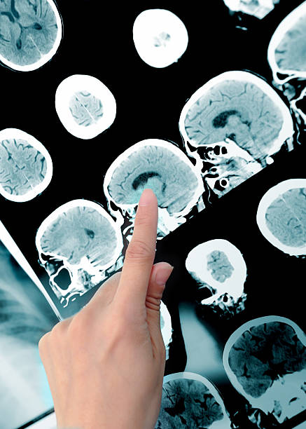 istock point to the imaging area. Doctor and CT-scan. 531926831