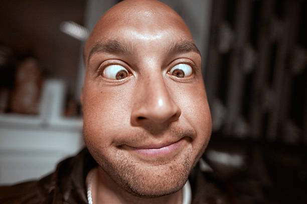 istock funny crossed eyed portrait 531942342