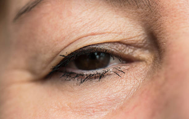 istock Elderly Woman Eye 531976974