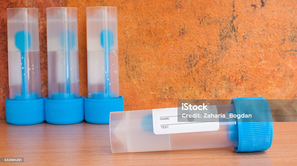 Stool sample jars with transport medium Stool sample jars with transport medium used in laboratory medicine Medical Sample Stock Photo