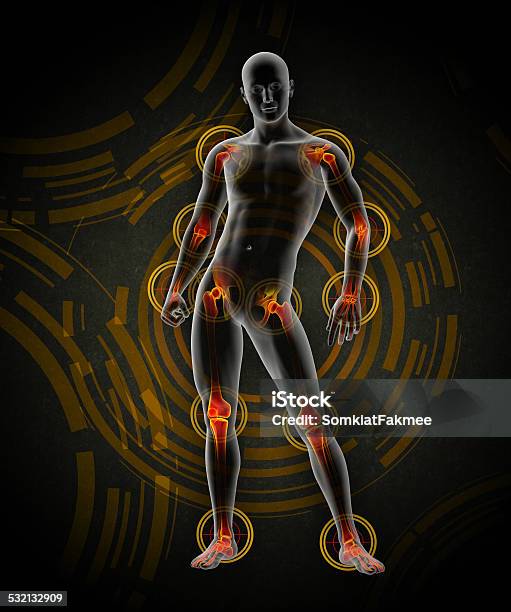 3d Rendered Medical Illustration Of A Painful Joint Stock Photo - Download Image Now