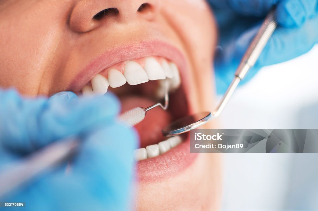 Frau Mund öffnen, während mündlichen im Zahnarzt untersuchen lassen. Selektive - Lizenzfrei Zahnarzt Stock-Foto