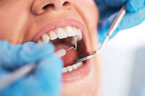 frau mund öffnen, während mündlichen im zahnarzt untersuchen lassen. selektive - zahnarzt stock-fotos und bilder