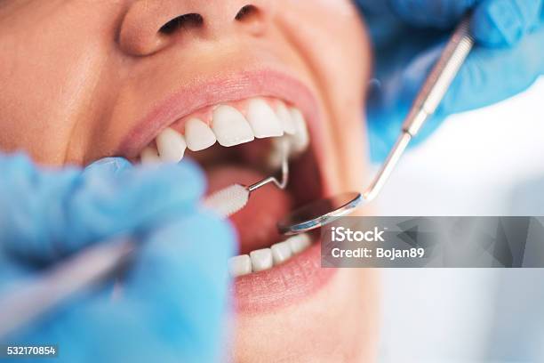 Frau Mund Öffnen Während Mündlichen Im Zahnarzt Untersuchen Lassen Selektive Stockfoto und mehr Bilder von Zahnarzt