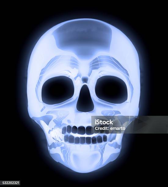 Xray Human Skull Stock Photo - Download Image Now - 2015, Anatomy, Black Color