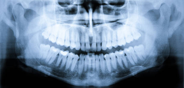 istock X-ray scan of teeth 532239311