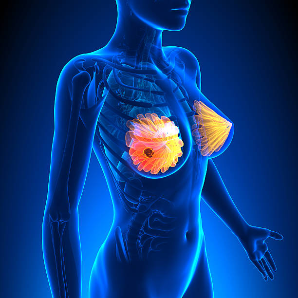 carcinoma mammario-femmina-tumore di evidenziare l'anatomia - areola foto e immagini stock