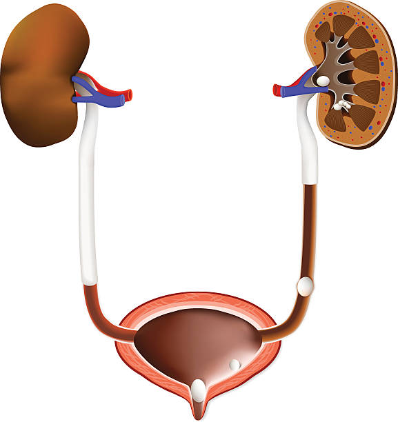 Stones in the kidney, urinary bladder and ureter Stones in the kidney, urinary bladder and ureter. medical illustration with a cross section of the kidney and bladder. anatomy of the urinary system. Human kidney. ureter stock illustrations