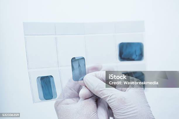Gloved Hands Holding Teeth Xray Stock Photo - Download Image Now - 2015, Close-up, Data