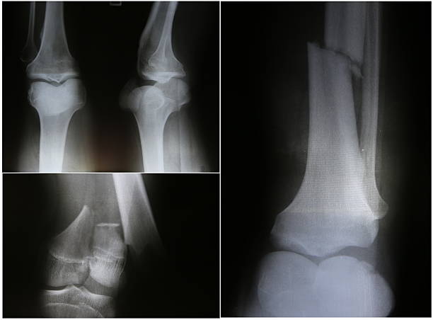 istock collection of film x-ray 532547694