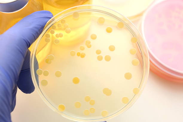 Differentiation of bacteria   (S.aureus) Differentiation of bacteria   (S.aureus) aureus stock pictures, royalty-free photos & images