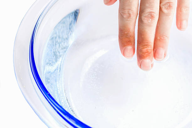 Woman puts her scalded hand into cold water stock photo
