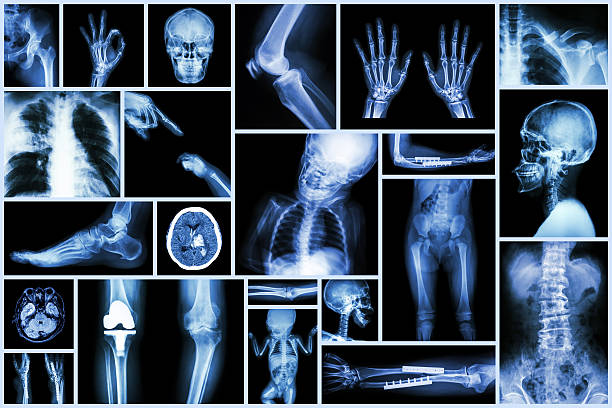 여러 부분으로 휴머니즘 & 정형외과 수술 & 여러 질병 - human lung x ray image x ray human spine 뉴스 사진 이미지