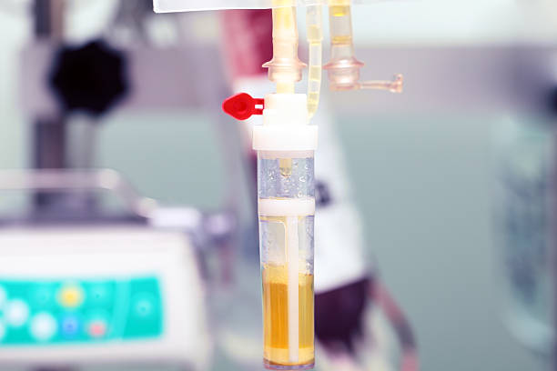 trasfusioni di plasma umano in ospedale - blood filter foto e immagini stock