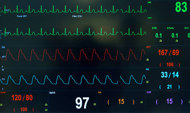 istock Heart Rate Monitor 532811043