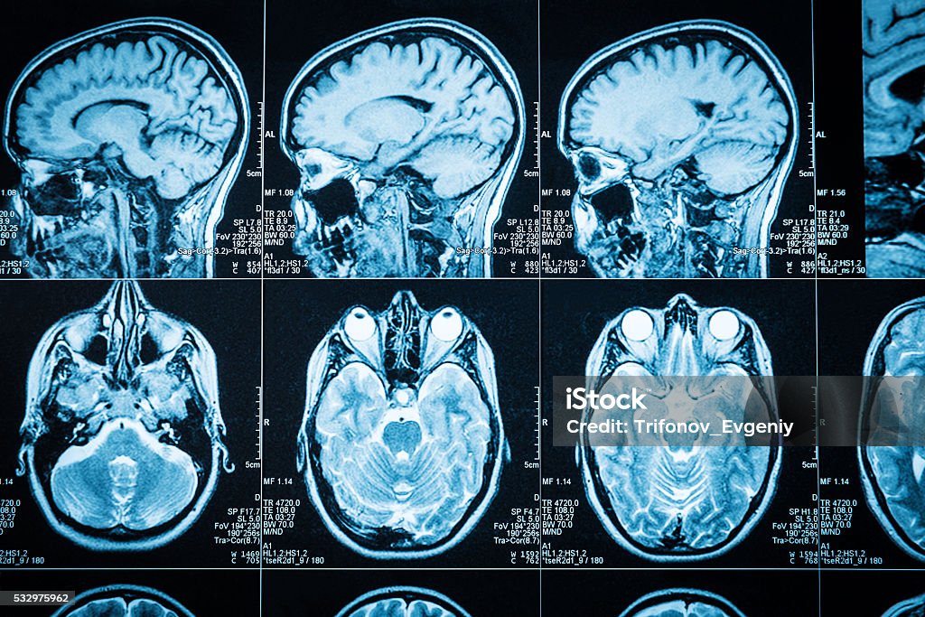 The brain Closeup of a CT scan with brain Medical Scan Stock Photo