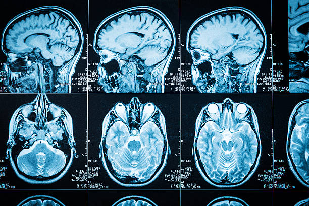 The brain Closeup of a CT scan with brain radiologist photos stock pictures, royalty-free photos & images