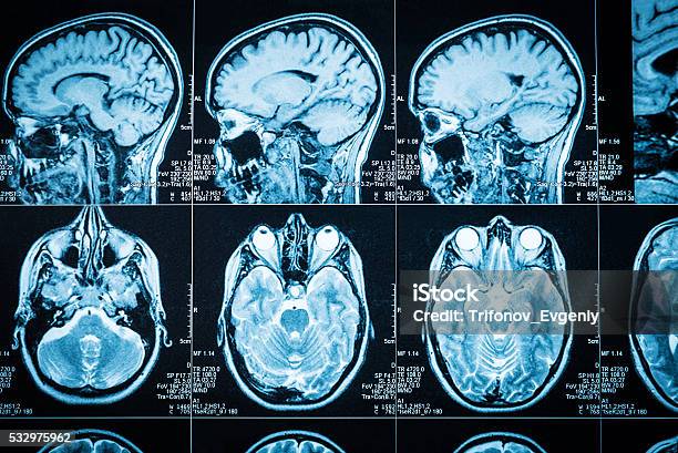 The Brain Stock Photo - Download Image Now - Medical Scan, MRI Scan, Medical Scanner