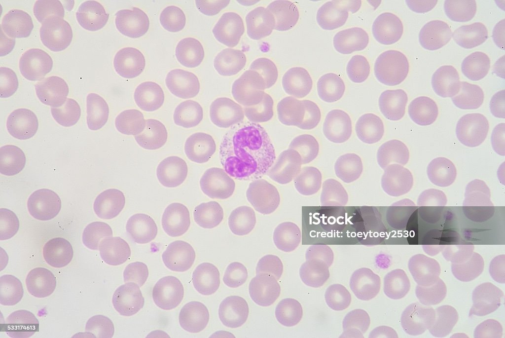 band form Neutrophil 2015 Stock Photo