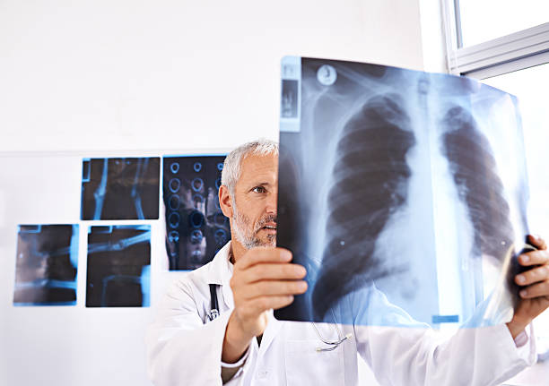 istock That looks like a broken rib to me 533256095