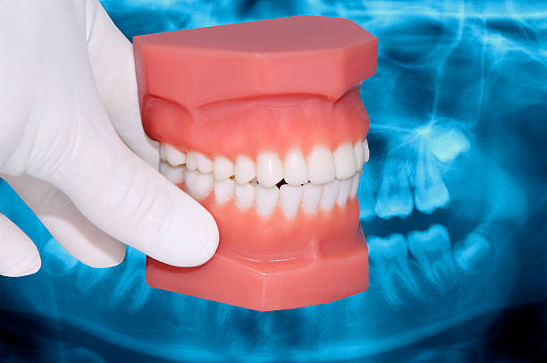 istock dentist hand show dental model over x-ray 533349224