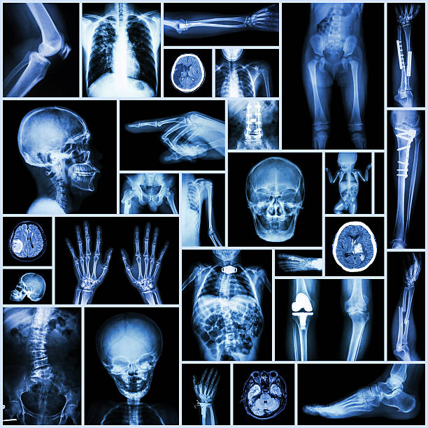 x-ray várias parte do homem, de cirurgia ortopédica e de várias doenças - cat scan pelvis hip human spine - fotografias e filmes do acervo