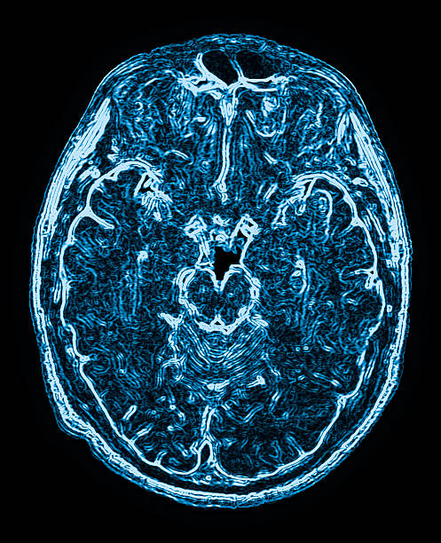 mri head magnetic resonance image stock photo